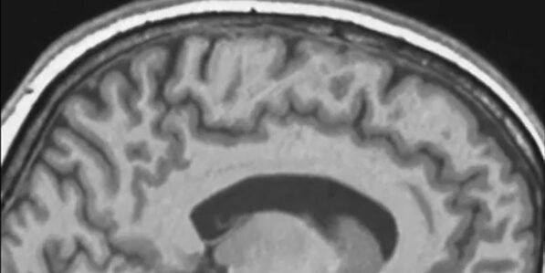 Backward and upward and tilted': Spaceflight causes astronauts ...