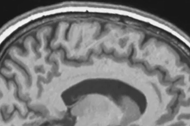 Backward and upward and tilted': Spaceflight causes astronauts ...