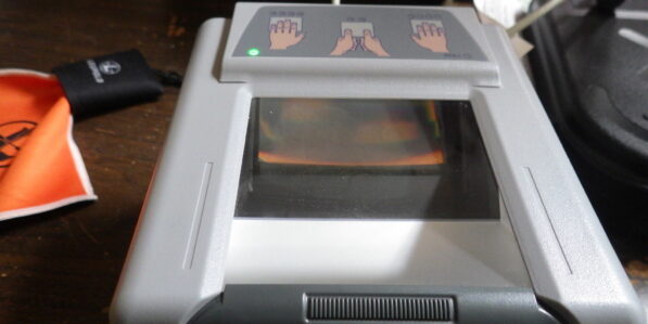 What does the appendix do? Biologists explain the complicated ...